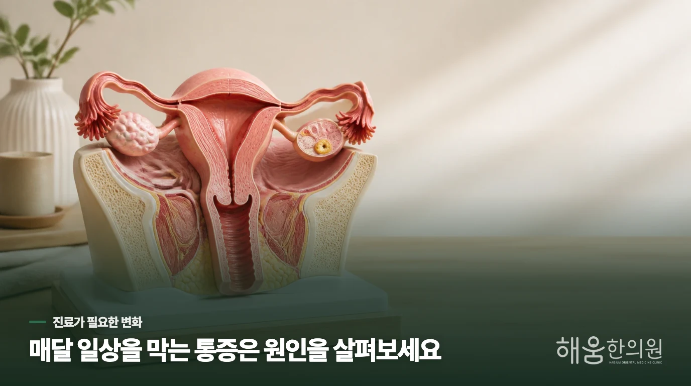 어떤 생리통이면 원인을 살펴야 할까요?